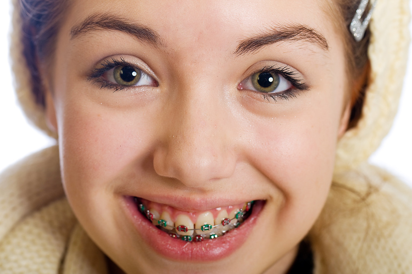 How much Dental Braces Cost in Los Angeles - West Hollywood Holistic and  Cosmetic Dental Care