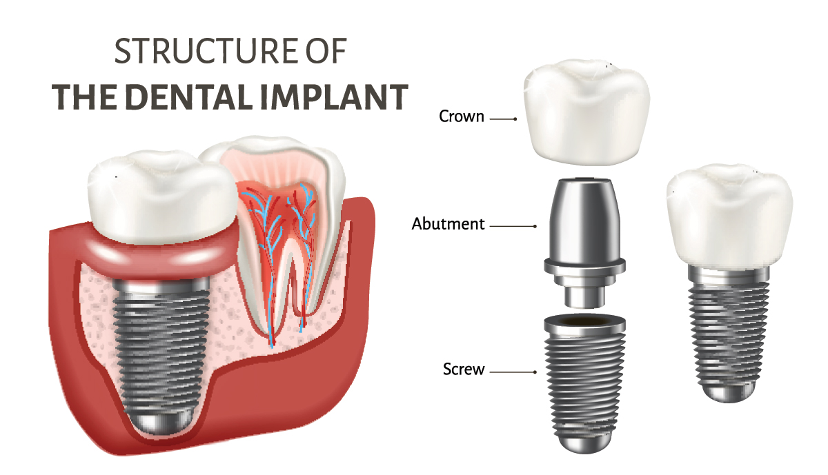 Dental Service Types at Amanda Coppola blog