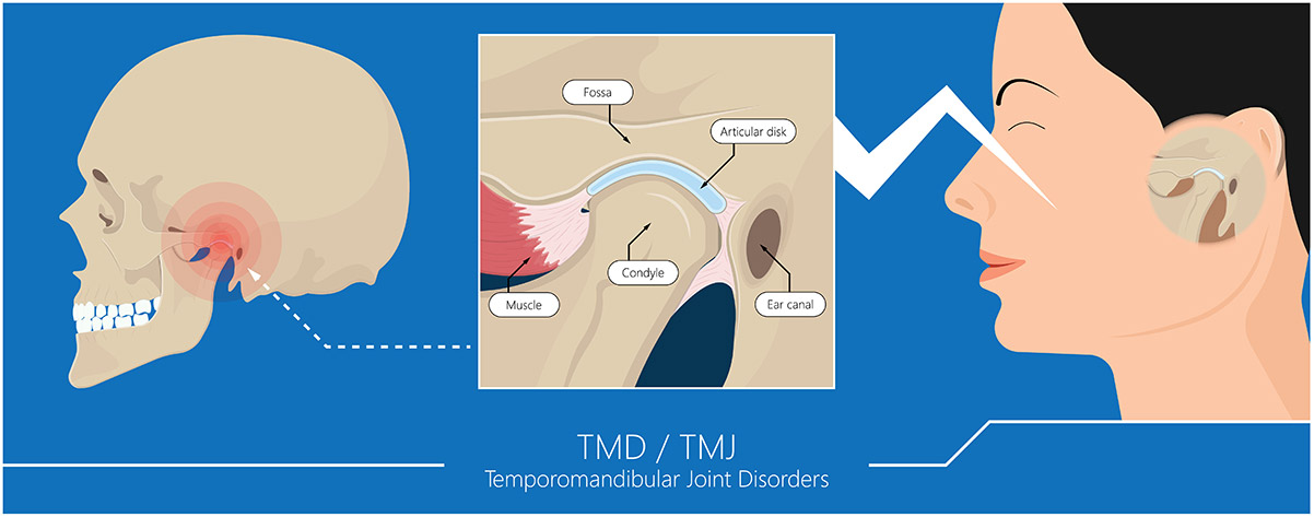 Tmj And Bite Correction Holistic Smile Care